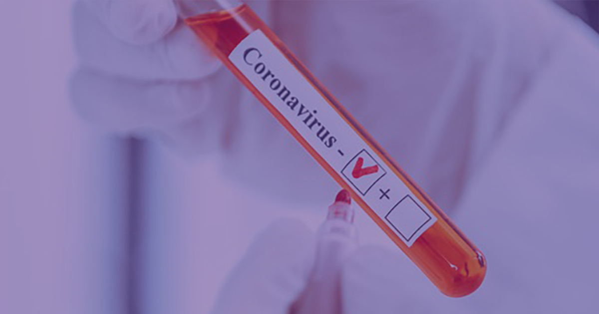 Novidade: Teste de Anticorpos Coronavírus Anti-Spike chega ao Labi